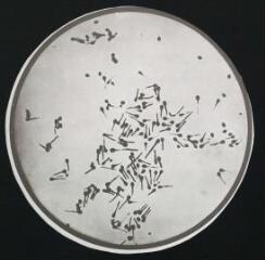 Bactériologie : bactérie du tétanos : vieille culture avec spores. - [entre 1905 et 1925]. - Photographie