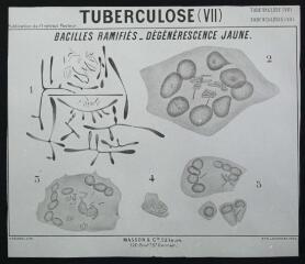 Bactériologie : publication de l'Institut Pasteur : tuberculose : bacilles ramifiés, dégénérescence jaune. - [entre 1905 et 1925]. - Photographie