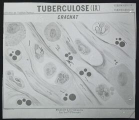 Bactériologie : publication de l'Institut Pasteur : tuberculose (IX) : crachat. - [entre 1905 et 1925]. - Photographie